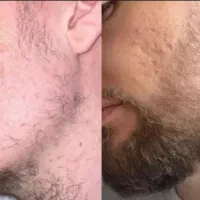 لامصب از کوسه بودن خسته نشدی