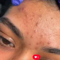 آموزش کاملا رایگان فیشال