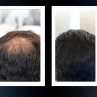 معجزه قرن