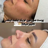 فیشیال
