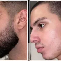 ریش خوش فرم باانتخاب هوشمندانه