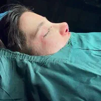 جراحی بینی با نرخ دولتی
