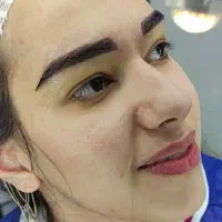 میکرو کاشت ابرو با تخفیف ویژه