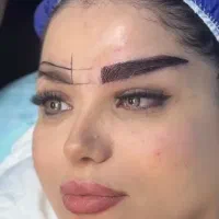 کاشت ابرو جدیدترین متد بدون مسواکی شدن باضمانت کار
