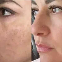 کرم بیوممتیک جوانساز کلاژن ضدلک و ضد چروک اصل