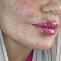 آموزش فیلر