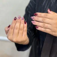 کاشت وترمیم ناخن با تخفیف ویژه