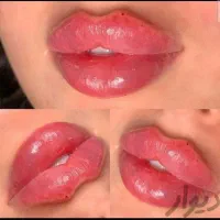 کلینیک تزریق ژل بوتاکس آنزیم فیلر لب شقیقه