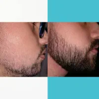 این محرم رو که بدون ریش بودی