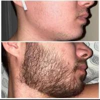 ریش نداری هنوز