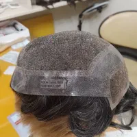 پروتز مو ،چسب مو