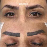 ریموو تتو ابرو پاک کردن تتو تک جلسه ای