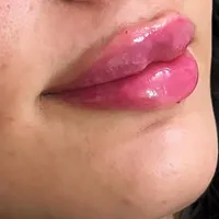 فیلر/ژل لب صورت کاشت مژه روباهی/کایلی..|خدمات آرایشگری و زیبایی|پاکدشت, |دیوار