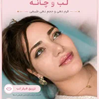 فیلر لب فقط ۹۹۹/۰۰۰(با بوتاکس چشم گربه ای رایگان)