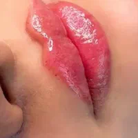 جشنواره فیلر وبوتاکس با تخفیف ویژه