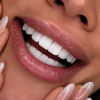 دندان پزشکی/دندانسازی/کامپوزیت/روکش/عصب کشی