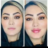آموزش خدمات بوتاکس فیلر شیراز، کوشک میدان