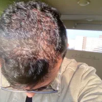 نزار کف سرت مثل کف دستت بشه