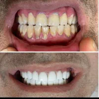 دندانپزشکی با تعرفه پایین و کیفیت بالا
