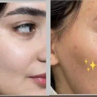 کرم جوانساز پوست ، مواد طبیعی گیاهی (ایتالیایی)