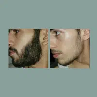 زیباشو|آرایشی، بهداشتی، درمانی|شمشک, |دیوار