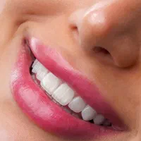 8 واحد کامپوزیت IPS با تکنیک لیرینگ فقط 30 تومن