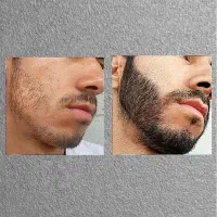 تقویت حرفه ای