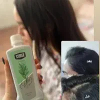نمایندگی رسمی تونیک مو هیرفرند(کلی جزئی)