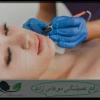 الکترولیز(رفع دائمی موهای سفید وسیاه)