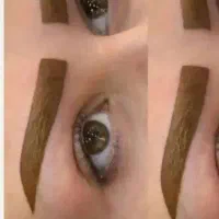 پلاسیون بدن