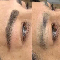 جشنواره عیدمیکروفیبروز ‌پاک کردن تتوشیدینگ ریموتتو