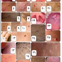 برای همیشه راحت شو|خدمات آرایشگری و زیبایی|کجور, |دیوار