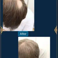 از جمع کچلا دربیا