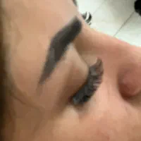 کاشت مژه هیدن و فیشر انیمه