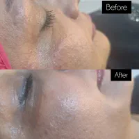 فیشیال