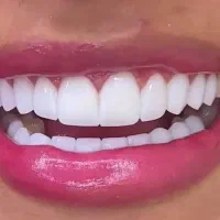 جشنواره تکرار نشدنی کامپوزیت