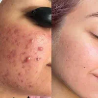 دمودکس|آرایشی، بهداشتی، درمانی|چابهار, |دیوار