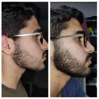 رشد دوباره حس تازه