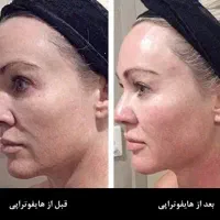 با ماهی ۷۹۵ تومان کل صورتتو هایفو کن