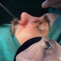 عمل بینی|خدمات آرایشگری و زیبایی|آبادان, |دیوار