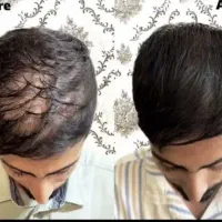 خسته شدی از موهات