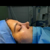 عمل بینی،بلفاروپلاستی،اتوپلاستی،لیفت شقیقه