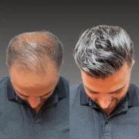 از ریزش تا رویش