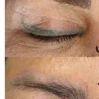 ریموو تخصصی تاتو ابرو خط چشم /پاک کردن تاتو قدیمی