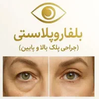 جراحی پلک بلفارو پلاستی لیفت شقیقه ...