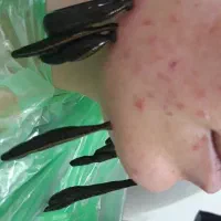 حجامت،فصدخون،زالو درمانی،طب سنتی،پی آر پی|خدمات آرایشگری و زیبایی|تهران, تهرانسر شمالی|دیوار