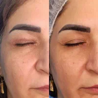 جشنواره عمل های زیبایی (اقساطی)