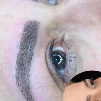 آموزش فیبروز ابرو