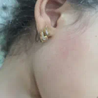 گل گوش گمشده