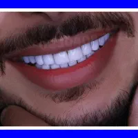 کامپوزیت دندان/دندانپزشکی/عصبکشی ترمیم روکش پالیش